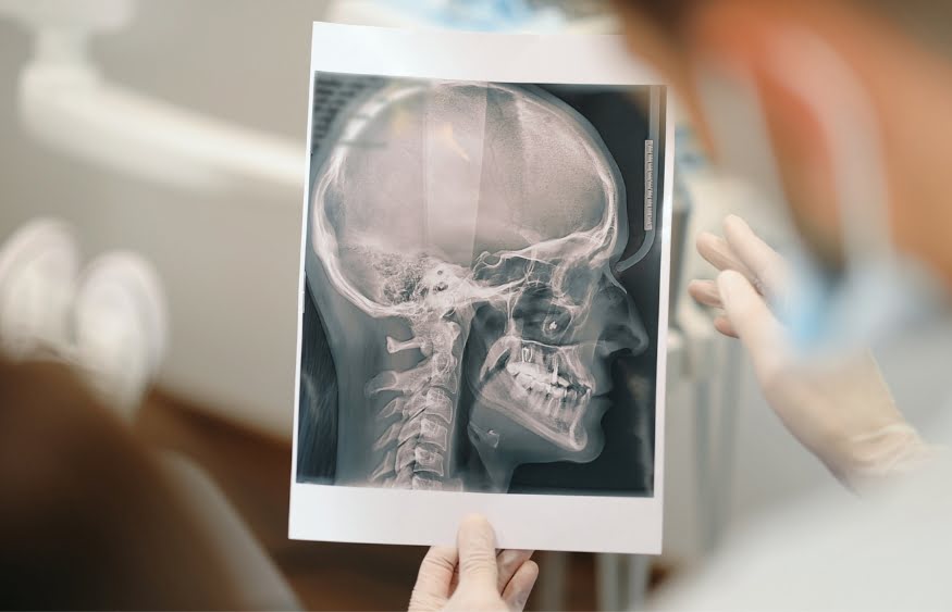 A radiologist in Winnipeg looking at an x-ray of a skull
