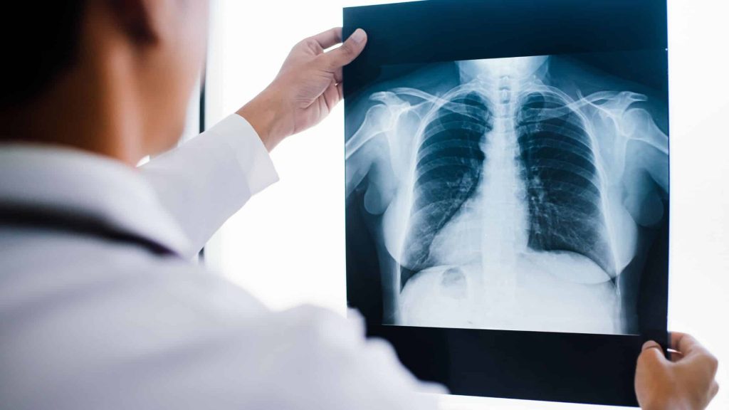 Doctor in Winnipeg observing an Xray image of back and spine