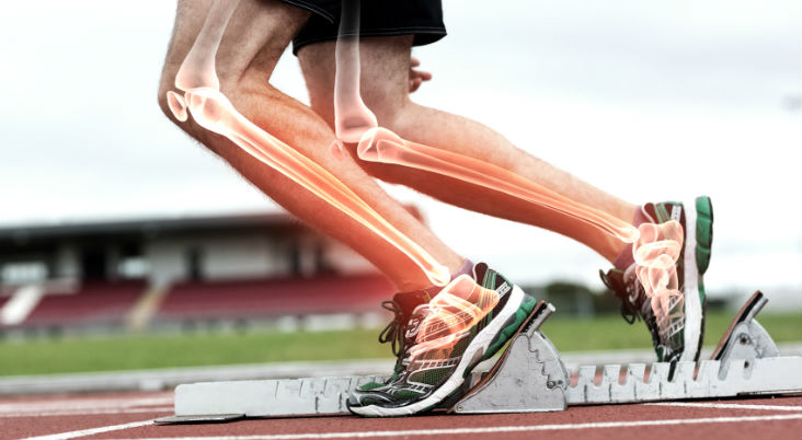 X-ray scan of a sports injury