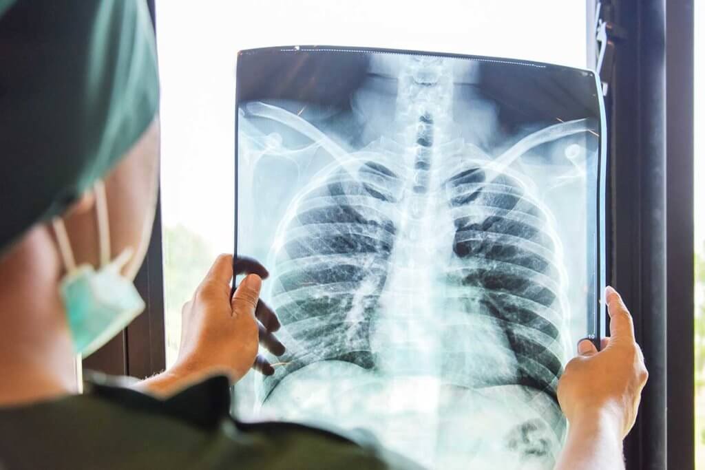 Female doctor looking at a chest xray image at an xray clinic in Manitoba